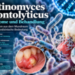 Actinomyces odontolyticus – příznaky a léčba – Herbert Eder – výzkumník v oblasti frekvencí Ilustrační obrázky bakterií a model zubu k článku o Actinomyces odontolyticus, možných infekcích a léčbě.