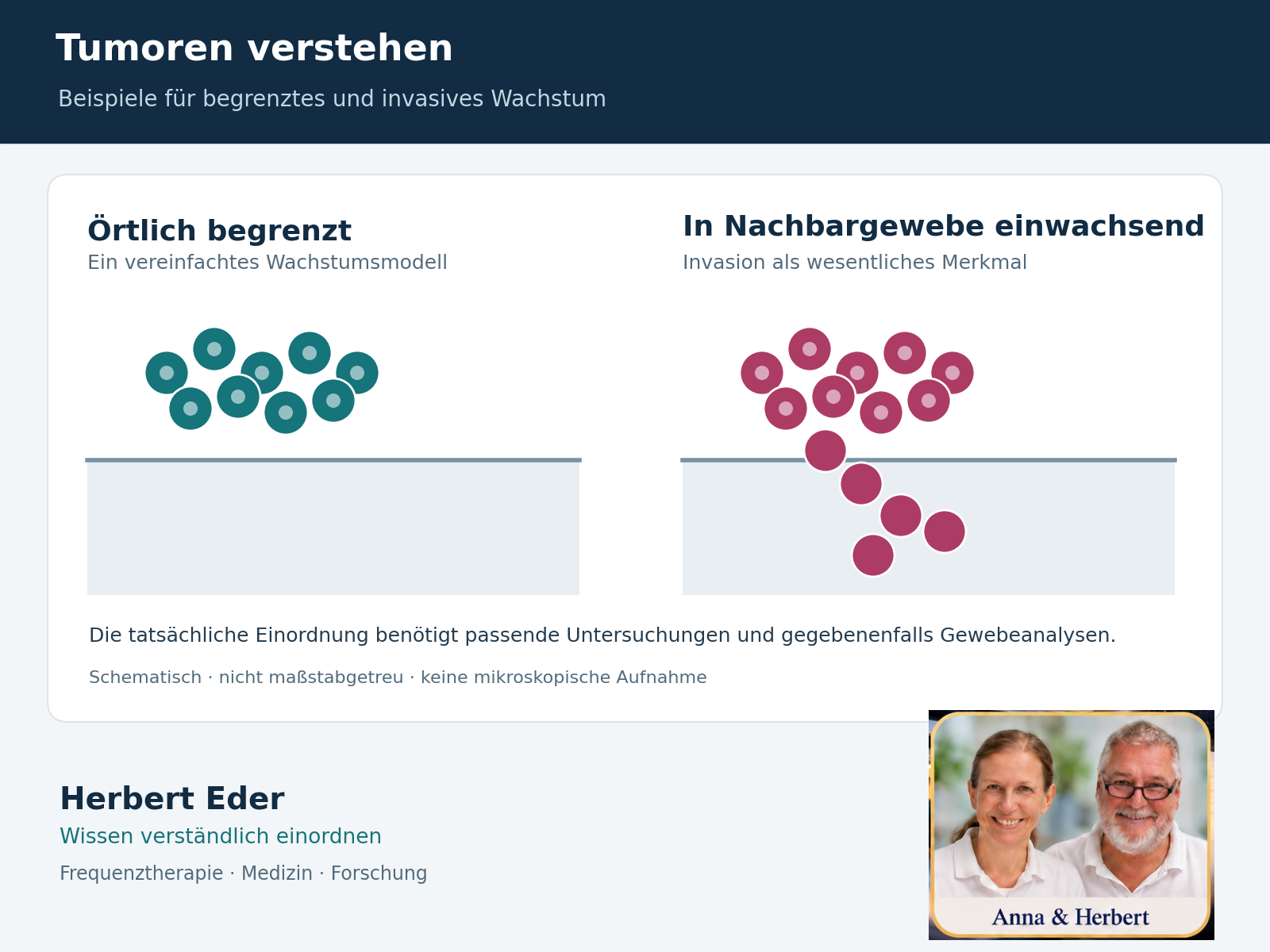 Zwei schematische Zellgruppen: örtlich begrenztes Wachstum und Einwachsen in benachbartes Gewebe.